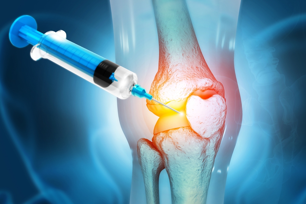 X-ray image showing stem cell injection into knee joint for stem cells for knees treatment